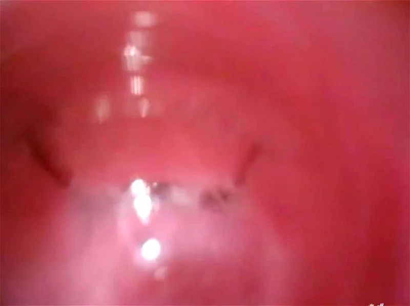 Extreme korean anal hairy sex Extreme korean anal hairy sex