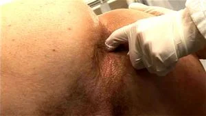 Prostate  thumbnail