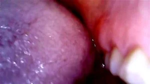 mouth thumbnail