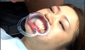 Japanese Bukkake Mouth Open - Watch Bukkake dentist - Dentist, Dentist Japanese, Japanese Dentist Porn -  SpankBang