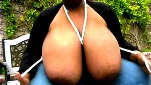 Big Breastisis thumbnail