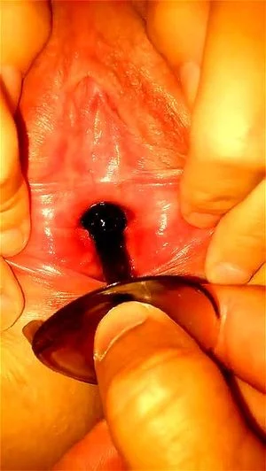 peehole thumbnail