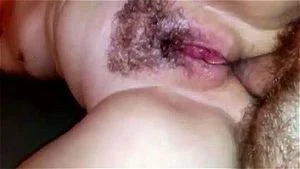 big labia hairy