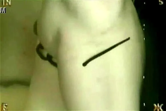 leeches leeches