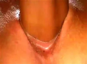 Anal thumbnail