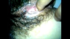 Hairy close up  thumbnail