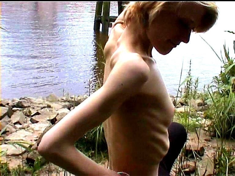 AnorexicLovers - Anna 1 AnorexicLovers - Anna 1
