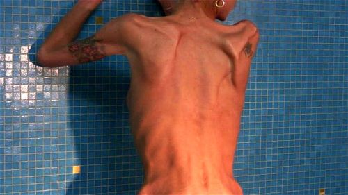 AnorexicLovers - Carmen 6: Fetish, Small Tits & Striptease Porn - SpankBang