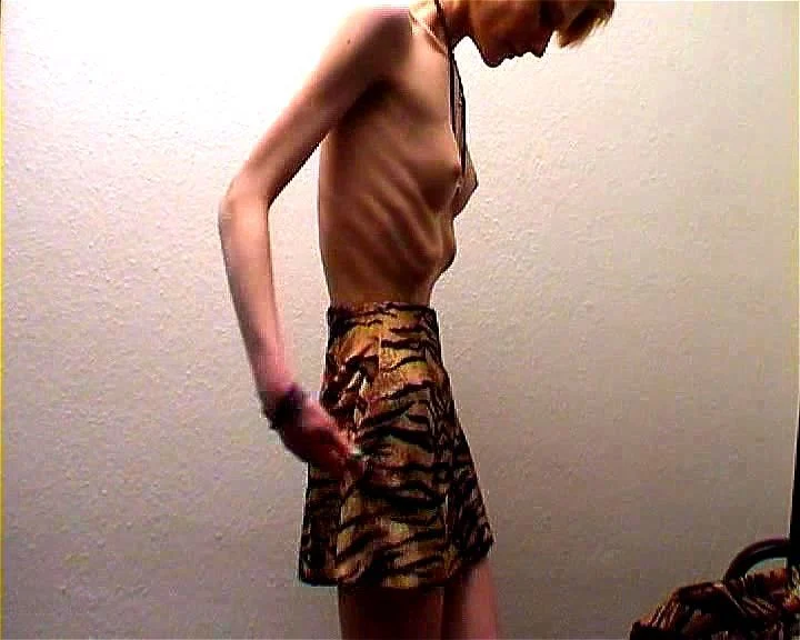 AnorexicLovers - Cindy and Anna AnorexicLovers - Cindy and Anna