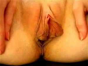 Labia thumbnail