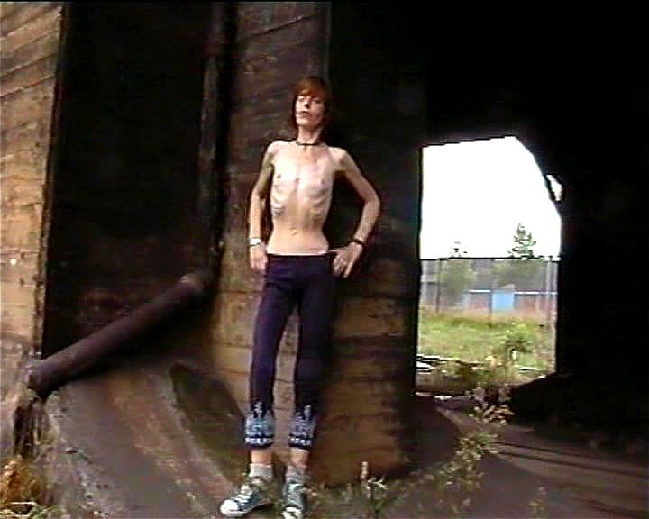 AnorexicLovers - Ilka AnorexicLovers - Ilka