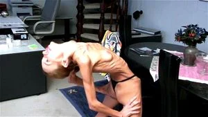 Anorexic thumbnail