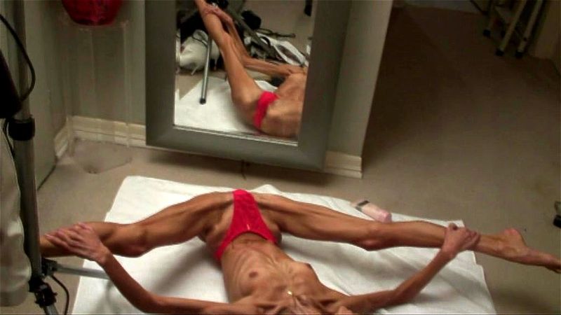 AnorexicLovers - Inna 18 AnorexicLovers - Inna 18