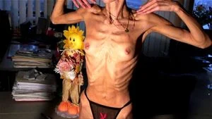 Anorexic thumbnail