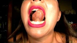 Uvula thumbnail