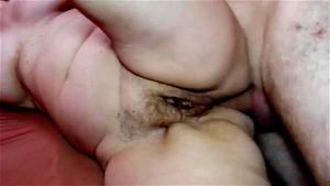 Anal hairy thumbnail