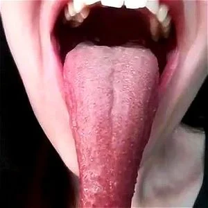 Tongue and mouth thumbnail