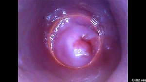 Endoscopes thumbnail