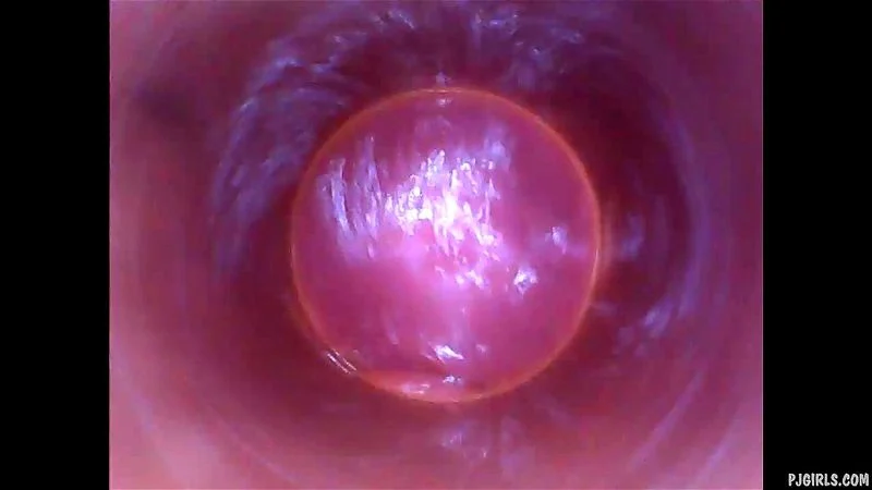 Naomi - Endoscopic Video