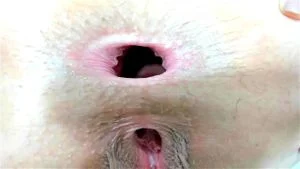 gape thumbnail