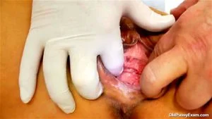 Old pussy exam thumbnail