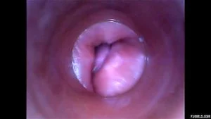 CERVIX thumbnail