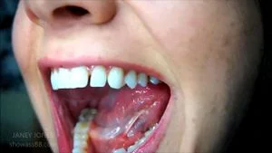 Mouth and saliva thumbnail