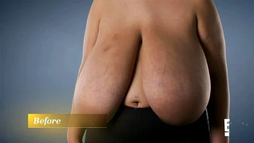 ugly, big boobs, big tits, macromastia