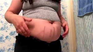 stretch marks thumbnail