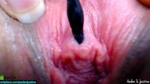 Urethra Cervix Hardcore thumbnail