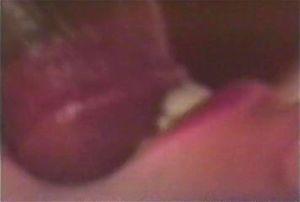 IR with brunette thumbnail