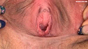 Close thumbnail