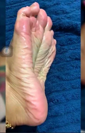 Feet thumbnail