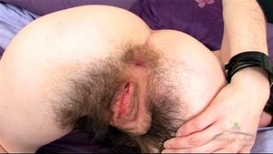 uk hairy thumbnail
