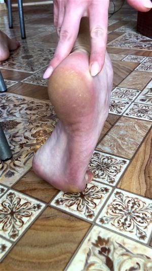 Sweaty feet thumbnail