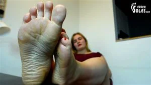 Calloused feet thumbnail