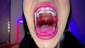 Watch from 0:31:29