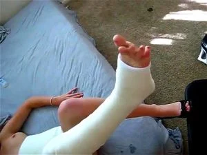 Body Cast Fetish Porn - Watch bodycast - Bodycast, Cast Castfetish, Babe Porn - SpankBang