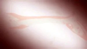 アニメ thumbnail
