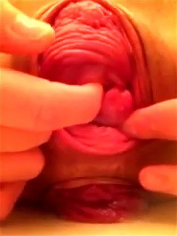 amateur, prolapse, vagina, close up