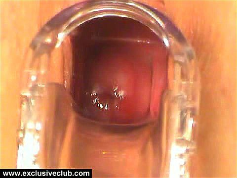 Watch Marsh Gyno exam - Gynecologist, Fetish, Vintage Porn