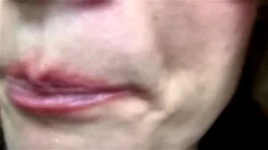 kiss thumbnail