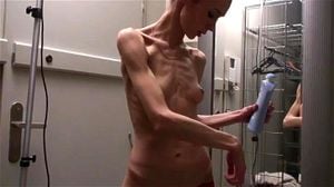 Anorexic thumbnail