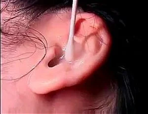 snoring thumbnail