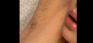 Hairy thumbnail