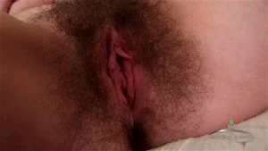 Hairy thumbnail