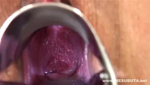 Watch from 0:09:15