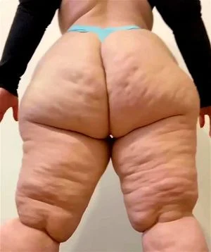 Cellulite  thumbnail