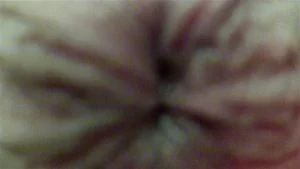 Anus close up thumbnail