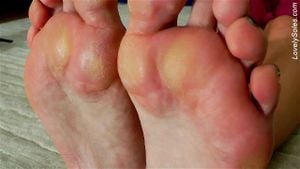 LOVERLY SOLES thumbnail